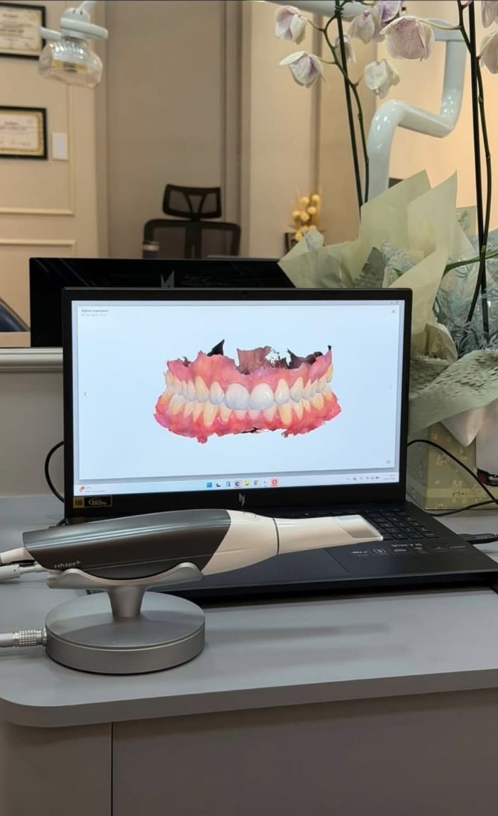 Scanner intraoral e modelo digital da arcada